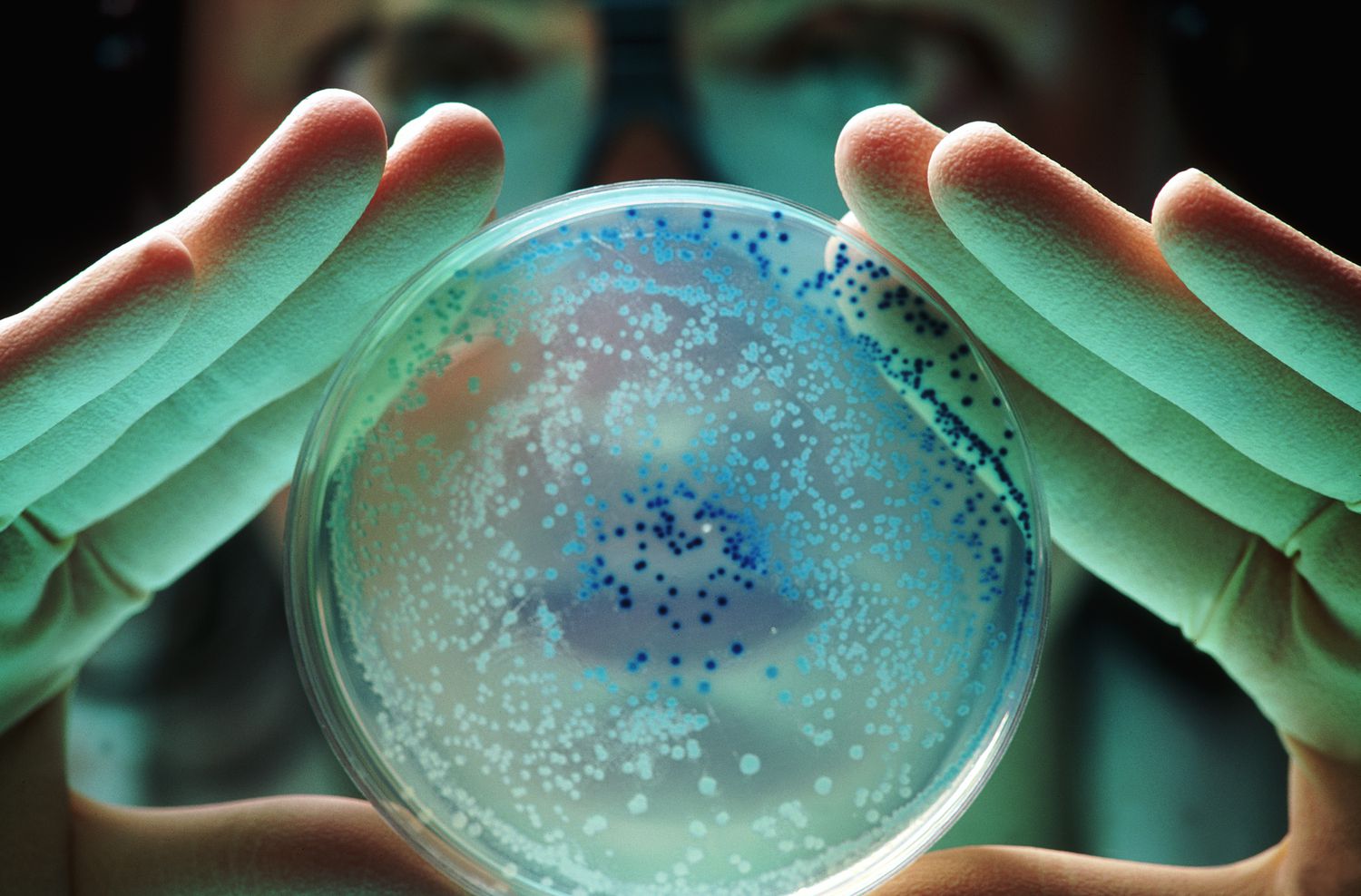 Las bacterias superresistentes, el otro gran problema de salud global frente al que también fuimos advertidos