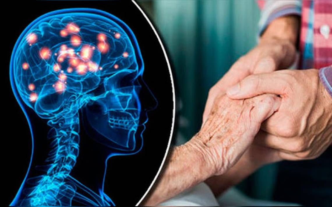 La cruel enfermedad de Huntington: hay esperanza