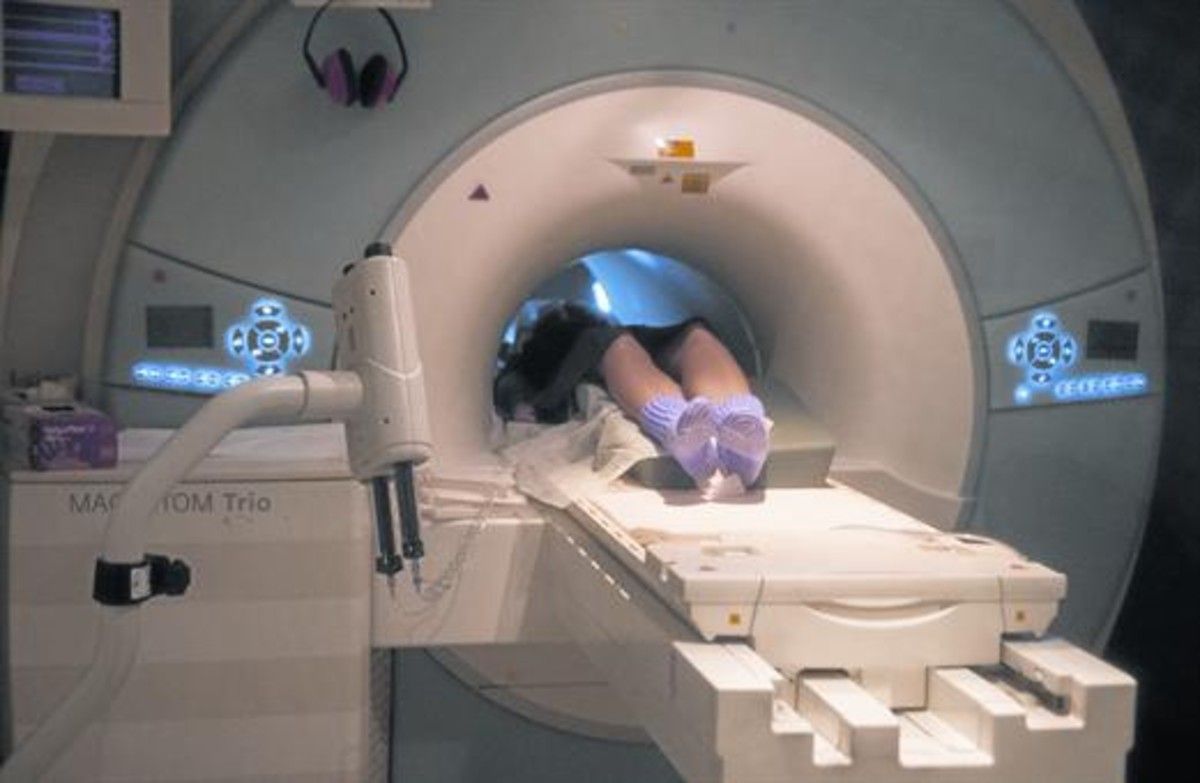 Un enfermo de ELA totalmente incomunicado es capaz de ‘hablar’ gracias a un implante cerebral